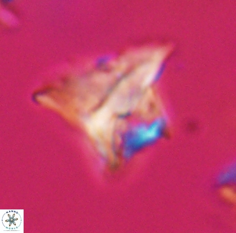 Orthorhabdus serratus 30374