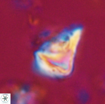 Orthorhabdus serratus 30380