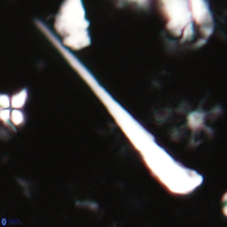 Orthorhabdus serratus VR 028102