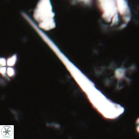 Orthorhabdus serratus VR 028102