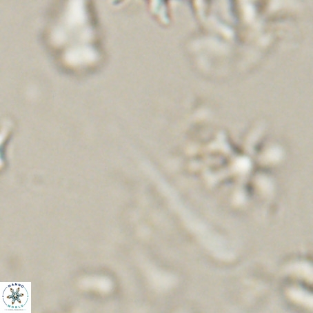 Orthorhabdus serratus VR 028115