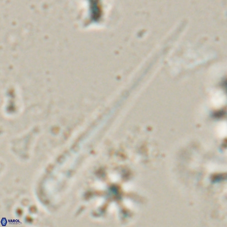 Orthorhabdus serratus VR 028116