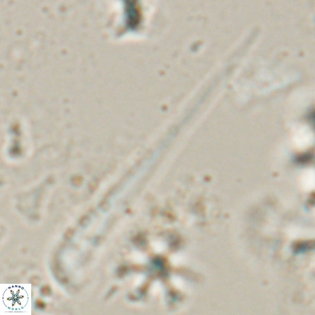 Orthorhabdus serratus VR 028116