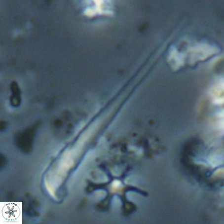 Orthorhabdus serratus VR 028117