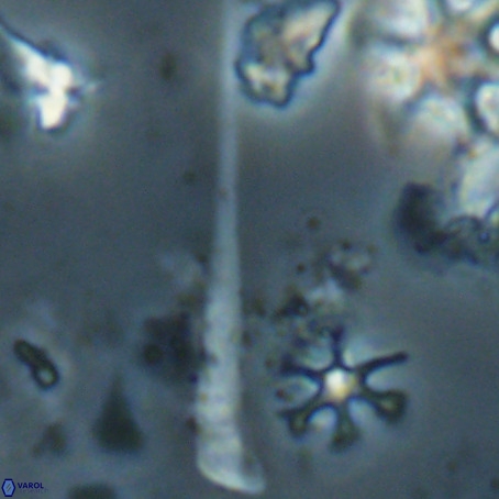 Orthorhabdus serratus VR 028118