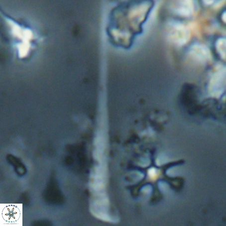 Orthorhabdus serratus VR 028118