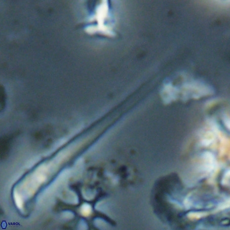 Orthorhabdus serratus VR 028119
