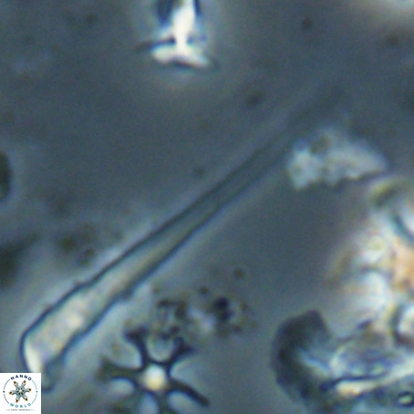 Orthorhabdus serratus VR 028119