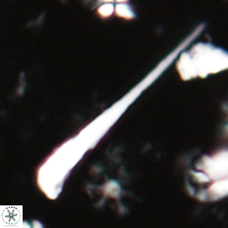 Orthorhabdus serratus VR 028110