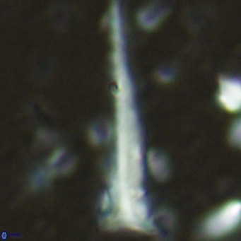 Orthorhabdus serratus VR 16849