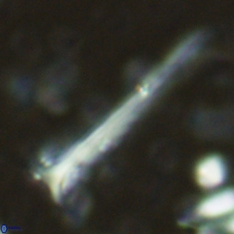 Orthorhabdus serratus VR 16858