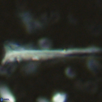 Orthorhabdus serratus VR 16860