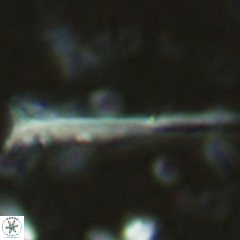 Orthorhabdus serratus VR 16860