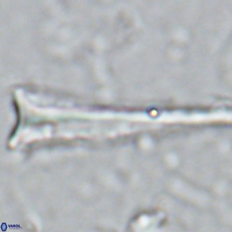 Orthorhabdus serratus VR 16861