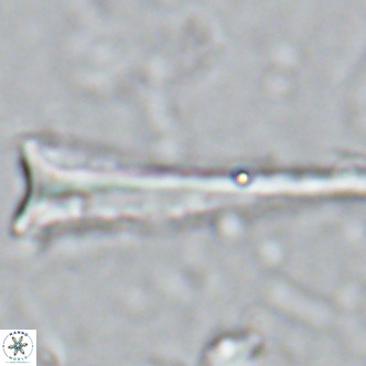 Orthorhabdus serratus VR 16861