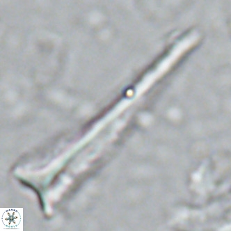 Orthorhabdus serratus VR 16864