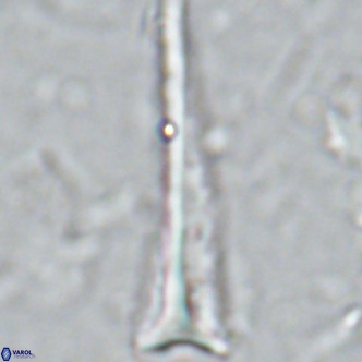 Orthorhabdus serratus VR 16865