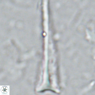 Orthorhabdus serratus VR 16865