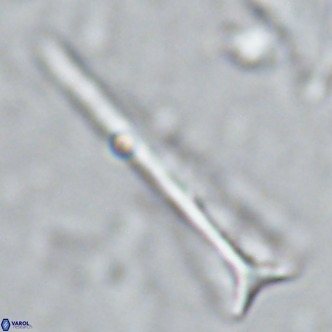Orthorhabdus serratus VR 16867