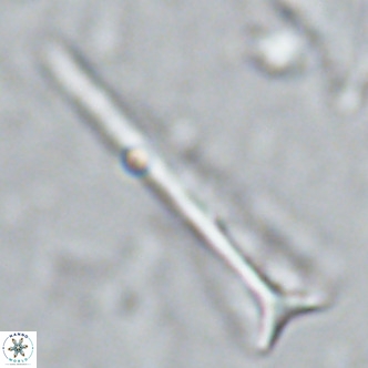 Orthorhabdus serratus VR 16867