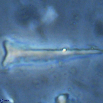 Orthorhabdus serratus VR 16871