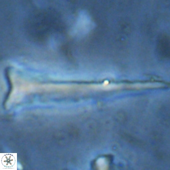 Orthorhabdus serratus VR 16871