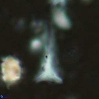 Orthorhabdus serratus VR 18044