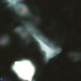 Orthorhabdus serratus VR 18045