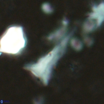 Orthorhabdus serratus VR 18048
