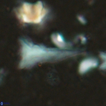 Orthorhabdus serratus VR 18052