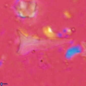 Orthorhabdus serratus VR 18053