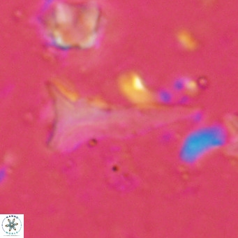 Orthorhabdus serratus VR 18053