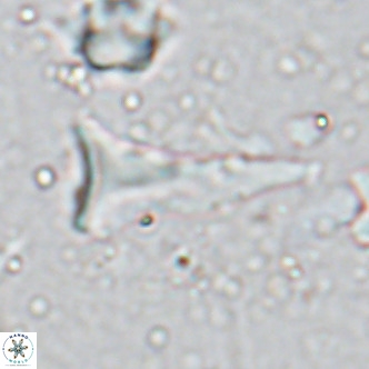 Orthorhabdus serratus VR 18055