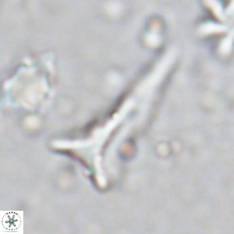 Orthorhabdus serratus VR 18056