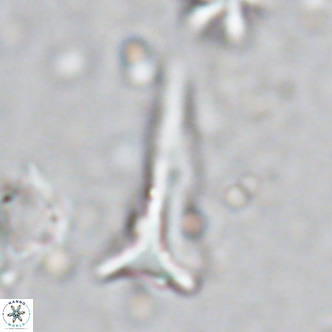 Orthorhabdus serratus VR 18058