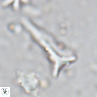 Orthorhabdus serratus VR 18059