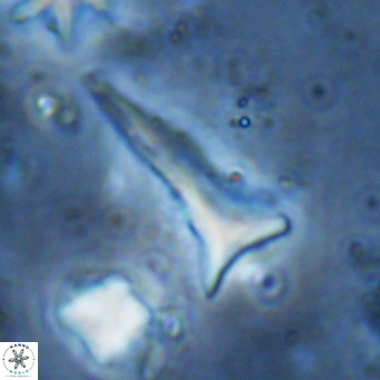 Orthorhabdus serratus VR 18060
