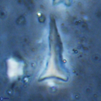 Orthorhabdus serratus VR 18061