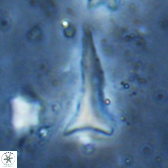 Orthorhabdus serratus VR 18061