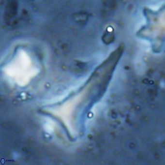 Orthorhabdus serratus VR 18062