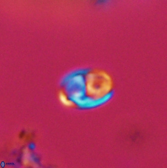 Owenia hillii VR 41835