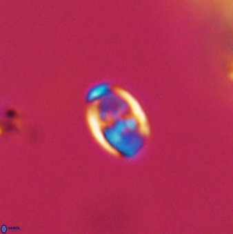 Owenia hillii VR 41837