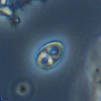 Owenia hillii VR 41839