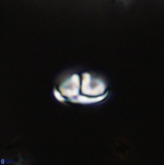 Owenia hillii VR 41832