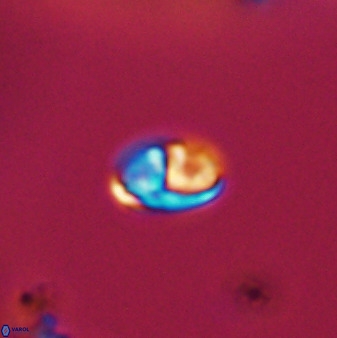 Owenia hillii VR 41833