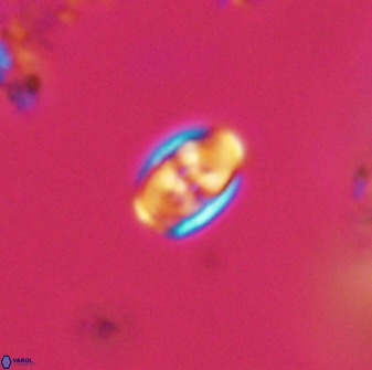 Owenia hillii VR 41846