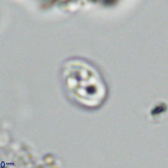 Owenia hillii VR 41843