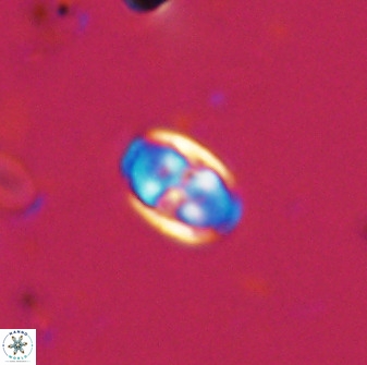 Owenia hillii 38034