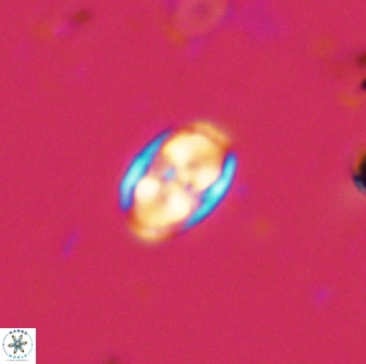 Owenia hillii 38040