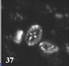 Prediscosphaera mgayae VR 15160